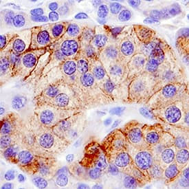 SEMA5A Antibody in Immunohistochemistry (Paraffin) (IHC (P))