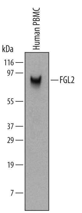 FGL2 Antibody in Western Blot (WB)