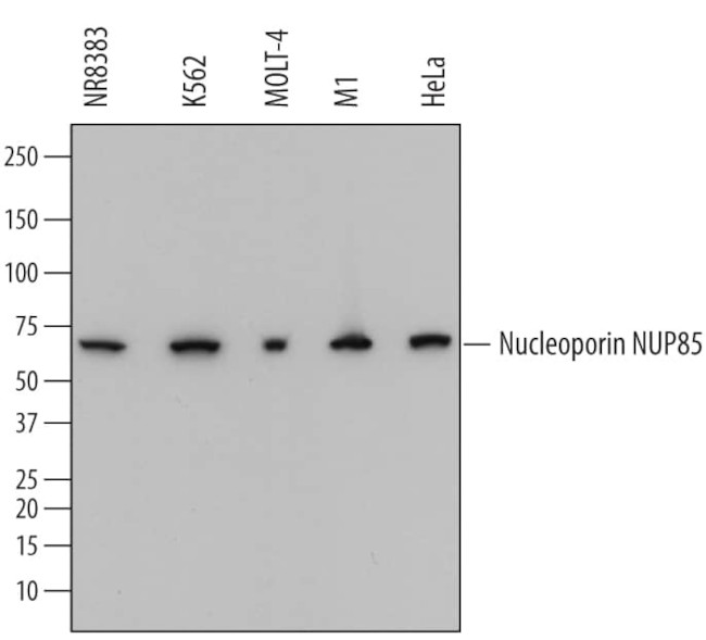 NUP85 Antibody in Western Blot (WB)