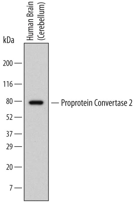 PCSK2 Antibody in Western Blot (WB)