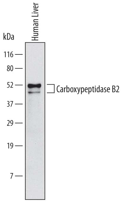 Carboxypeptidase B2 Antibody in Western Blot (WB)