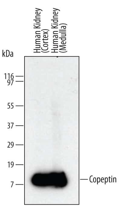 Copeptin Antibody in Western Blot (WB)