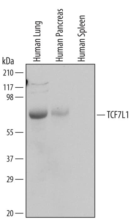 TCF7L1 Antibody in Western Blot (WB)