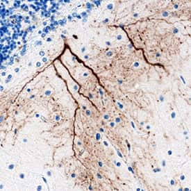 VWC2 Antibody in Immunohistochemistry (Paraffin) (IHC (P))