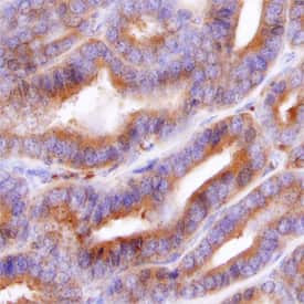 SULT2B1 Antibody in Immunohistochemistry (Paraffin) (IHC (P))
