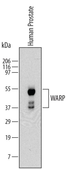 VWA1 Antibody in Western Blot (WB)