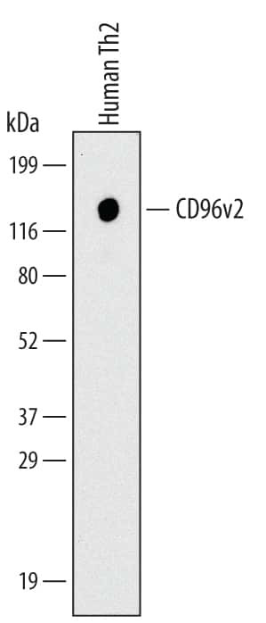 CD96v2 Antibody in Western Blot (WB)