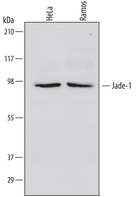PHF17 Antibody in Western Blot (WB)