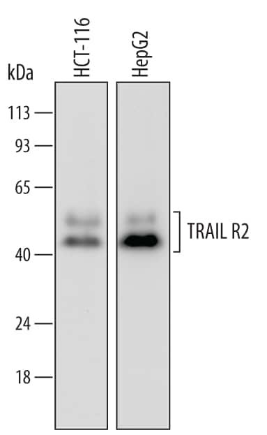 TRAIL-R2 (DR5) Antibody in Western Blot (WB)