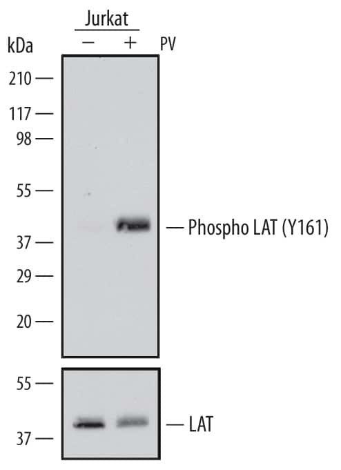 Phospho-LAT (Tyr161) Antibody in Western Blot (WB)