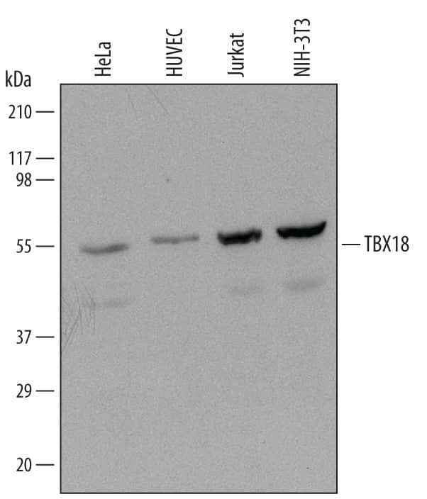 TBX18 Antibody in Western Blot (WB)