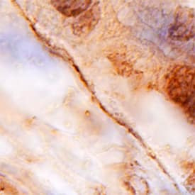 COL13A1 Antibody in Immunohistochemistry (Paraffin) (IHC (P))