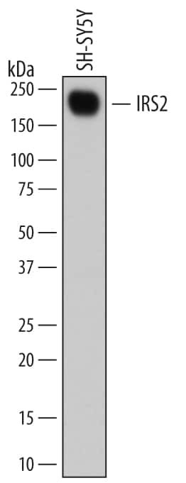 IRS2 Antibody in Western Blot (WB)