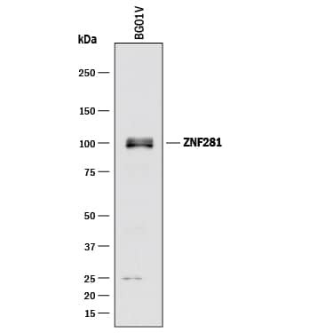 ZNF281 Antibody in Western Blot (WB)