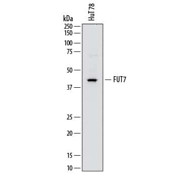 FUT7 Antibody in Western Blot (WB)