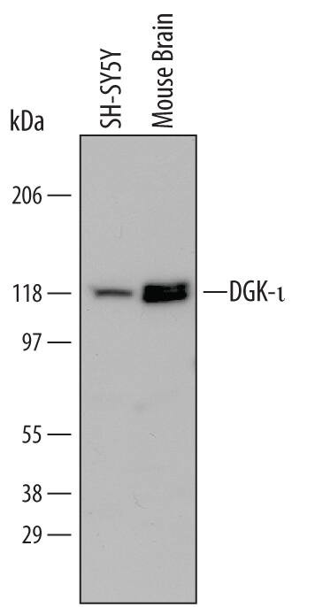 DGKI Antibody in Western Blot (WB)