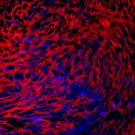 PRELP Antibody in Immunocytochemistry (ICC/IF)