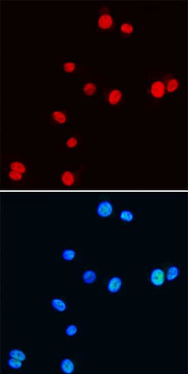 Nkx3.1 Antibody in Immunocytochemistry (ICC/IF)
