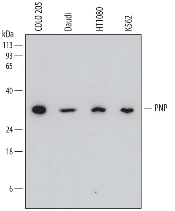 PNP Antibody in Western Blot (WB)