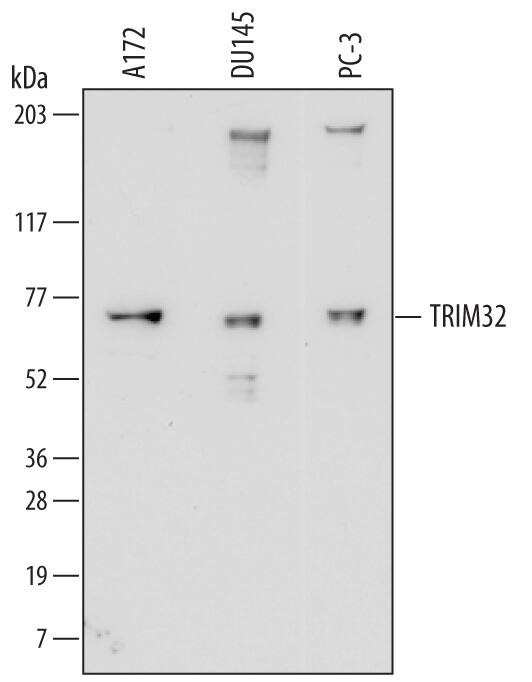 TRIM32 Antibody in Western Blot (WB)
