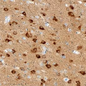 Amphiphysin Antibody in Immunohistochemistry (Paraffin) (IHC (P))