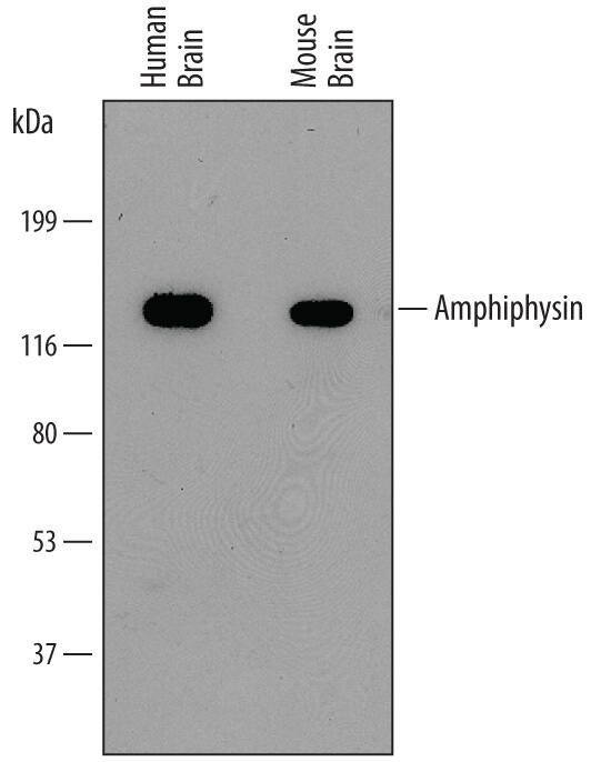 Amphiphysin Antibody in Western Blot (WB)