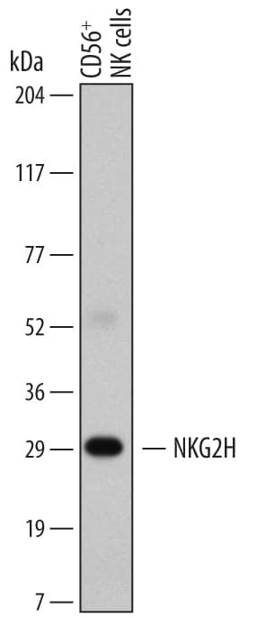 NKG2H Antibody in Western Blot (WB)