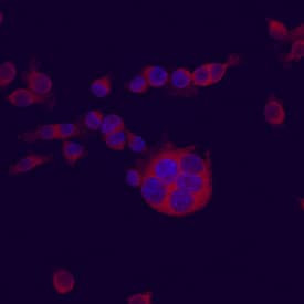 SLC25A19 Antibody in Immunocytochemistry (ICC/IF)