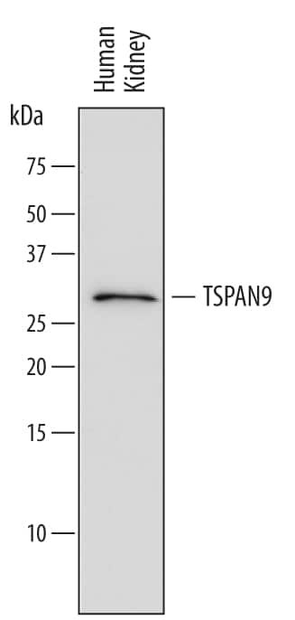 TSPAN9 Antibody in Western Blot (WB)