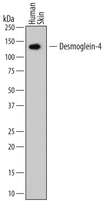 Desmoglein 4 Antibody in Western Blot (WB)
