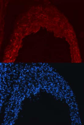 Nogo-B Antibody in Immunohistochemistry (Frozen) (IHC (F))