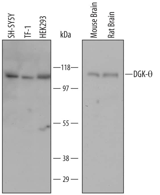 DGKQ Antibody in Western Blot (WB)