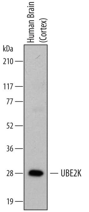 HIP2 Antibody in Western Blot (WB)