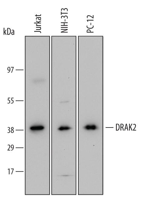 DRAK2 Antibody in Western Blot (WB)