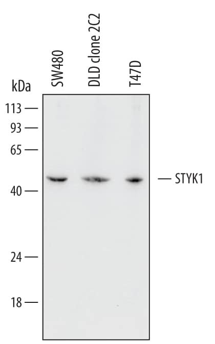STYK1 Antibody in Western Blot (WB)