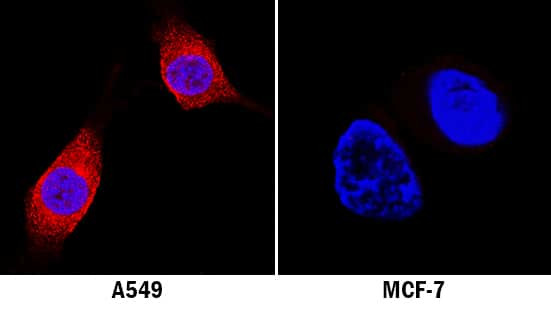 LRRK2 Antibody in Immunocytochemistry (ICC/IF)