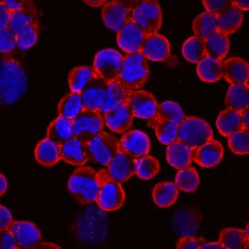 PCDH15 Antibody in Immunocytochemistry (ICC/IF)