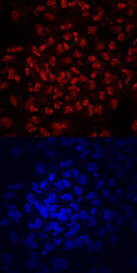 ZNF143 Antibody in Immunocytochemistry (ICC/IF)