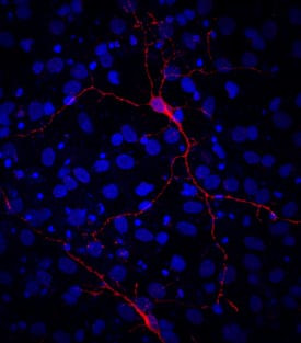 VGAT Antibody in Immunocytochemistry (ICC/IF)