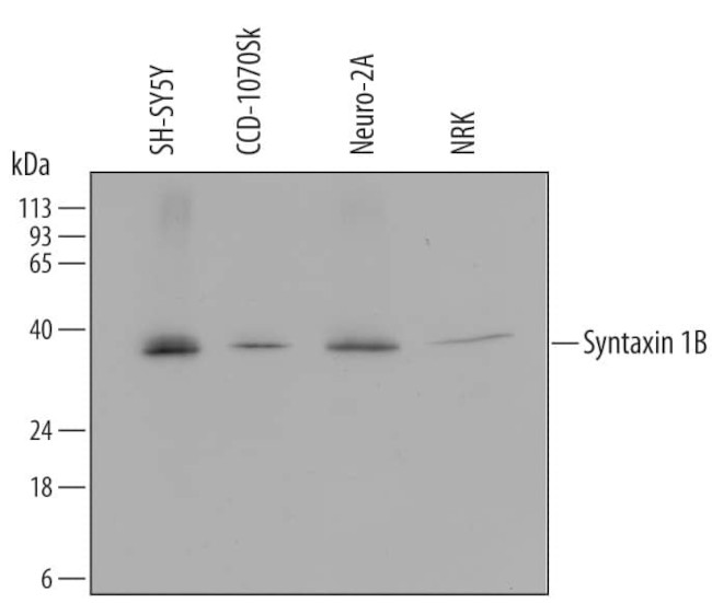 STX1B Antibody in Western Blot (WB)