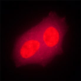Bora Antibody in Immunocytochemistry (ICC/IF)