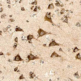 PEN2 Antibody in Immunohistochemistry (Paraffin) (IHC (P))