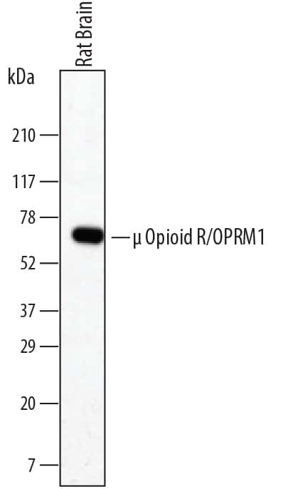 OPRM1 Antibody in Western Blot (WB)