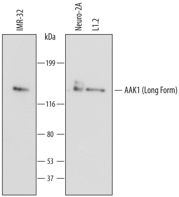 AAK1 Antibody in Western Blot (WB)