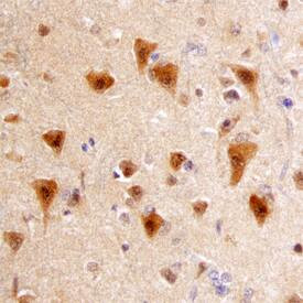 APH1 Antibody in Immunohistochemistry (Paraffin) (IHC (P))