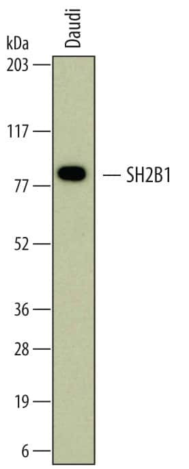 SH2B1 Antibody in Western Blot (WB)