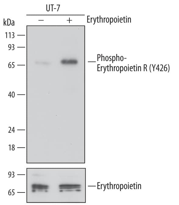 Phospho-EpoR (Tyr426) Antibody in Western Blot (WB)