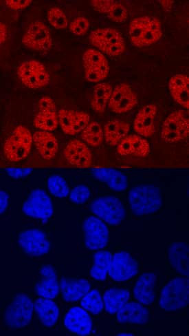 TCF12 Antibody in Immunocytochemistry (ICC/IF)