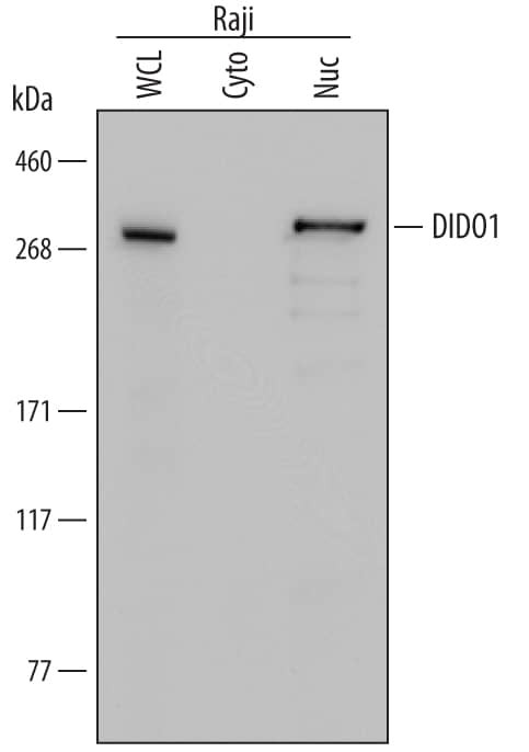 DATF1 Antibody in Western Blot (WB)