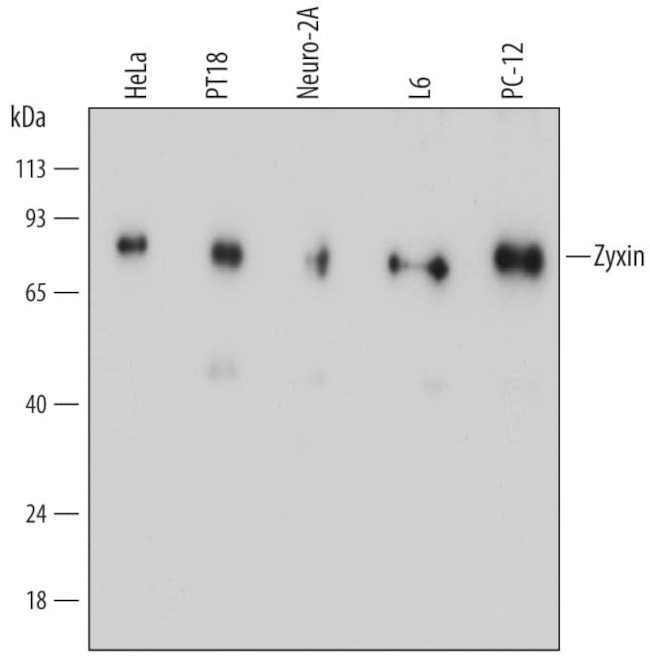 Zyxin Antibody in Western Blot (WB)